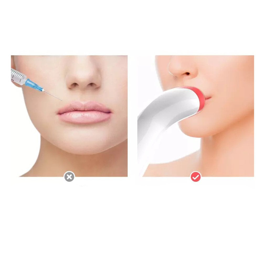 Electric Lip Enhancer - Rodammy